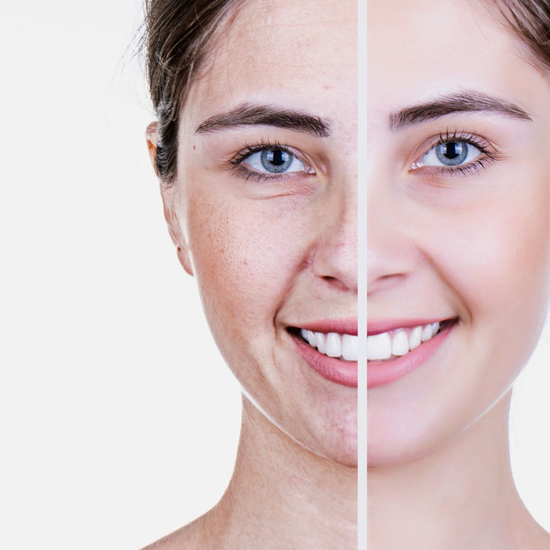 Anti-aging skincare before after